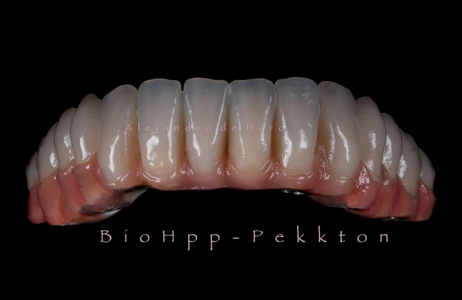 Close-up view of dental prosthetics labeled BioHpp-Pekkton on a black background.